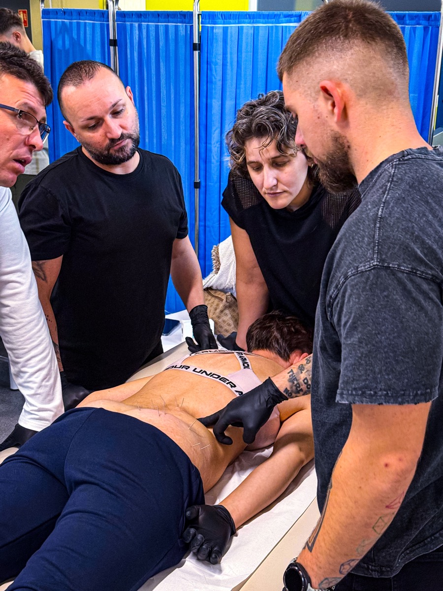 Curs dry needling — formare avansată, 2025
